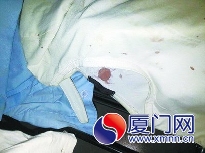 嫌疑人的衣服上沾著的哥的血