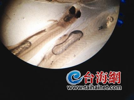 體內(nèi)物質(zhì)