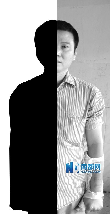 黃廣現(xiàn)的手臂上仍打著石膏