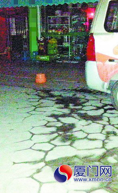 孩子就在自家店門口出事，肇事司機(jī)是家長的熟人。