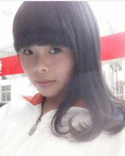 廈門17歲少女吃烤魚被燒成火人