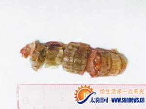 卡在小王喉嚨的蝦蛄