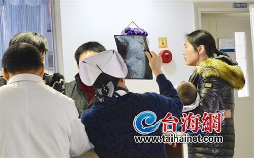 5厘米長縫衣針扎入小孩內臟 醫(yī)生為難如何取針