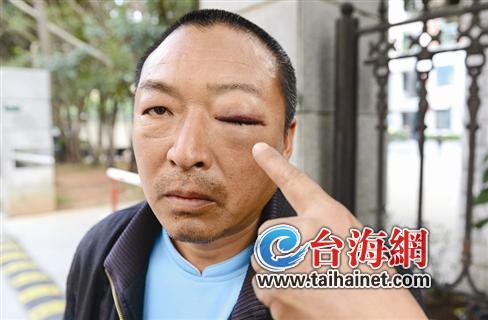 車主不聽勸還打保安