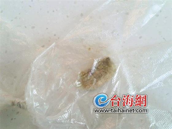 十幾天前林先生打噴嚏噴出異物