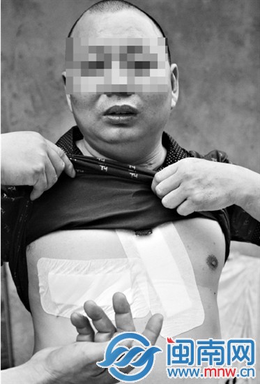 王先生的胸口被連刺了三刀，脖子上的刀傷已留下明顯