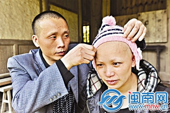 因?yàn)榛煹艄饬祟^發(fā)，妻子在家里也一直戴著帽子