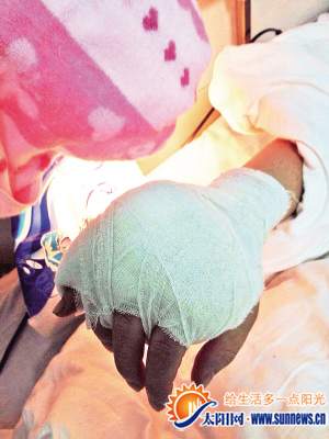 女子手指被砍斷