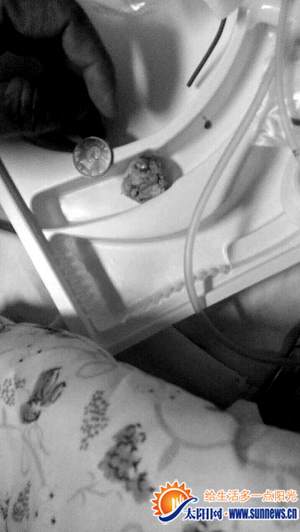 卡在沫沫喉嚨里的肉丸比5角硬幣稍大