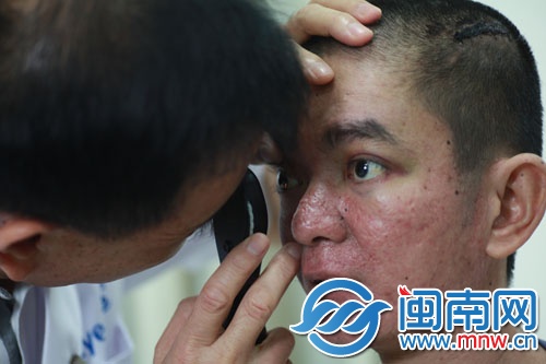 醫(yī)生建議丁山做腦部CT，才能確定眼睛有何問題