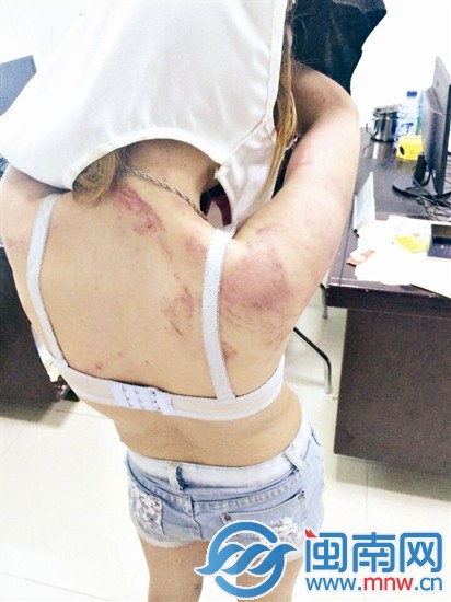 黃某在女警面前脫下衣服，身上傷痕累累